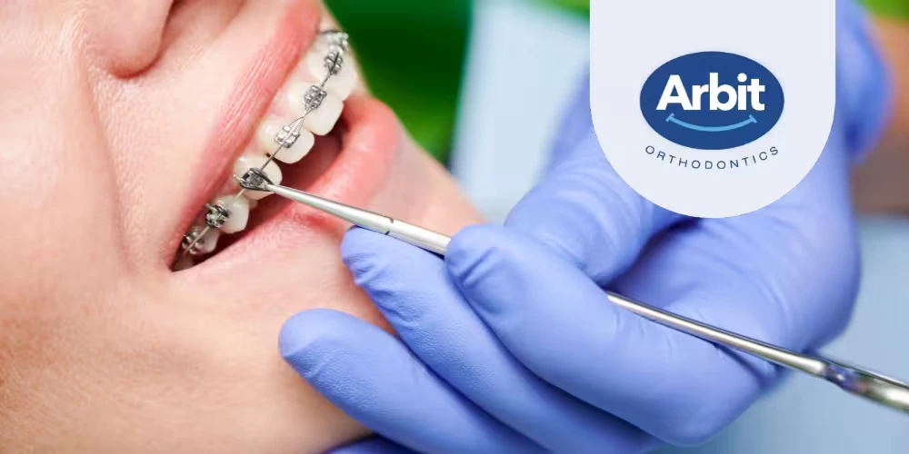 How Arbit Orthodontics Uses Advanced Technology for Orthodontic Treatments