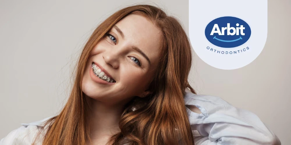 Image - Everything You Need to Know About Ceramic Braces